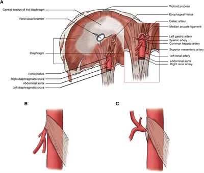 Ultrasound characteristics of abdominal vascular compression syndromes